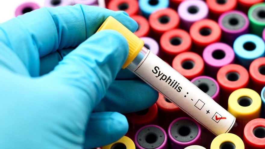 Dinkes Bateng Catat 3 Kasus Sifilis di Tahun 2022, Ingatkan Jangan Gonta Ganti Pasangan