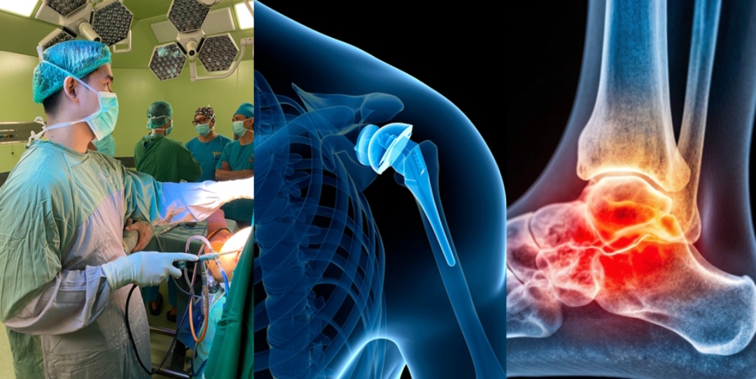 Dokter Spesialis Tulang Garda Terdepan  Penanganan Gangguan Tulang dan Sendi