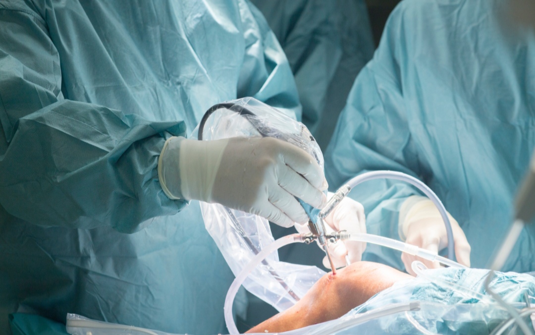 Arthroscopy: Solusi Bedah Minimal Invasif untuk Masalah Sendi