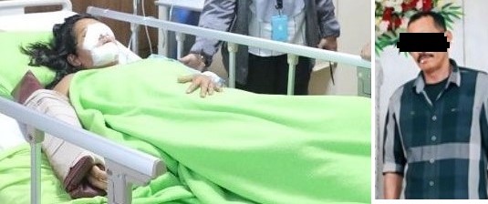 Mayat Supri Dibawa ke RS Bhayangkara, Nurlaela Menderita Buta Permanen