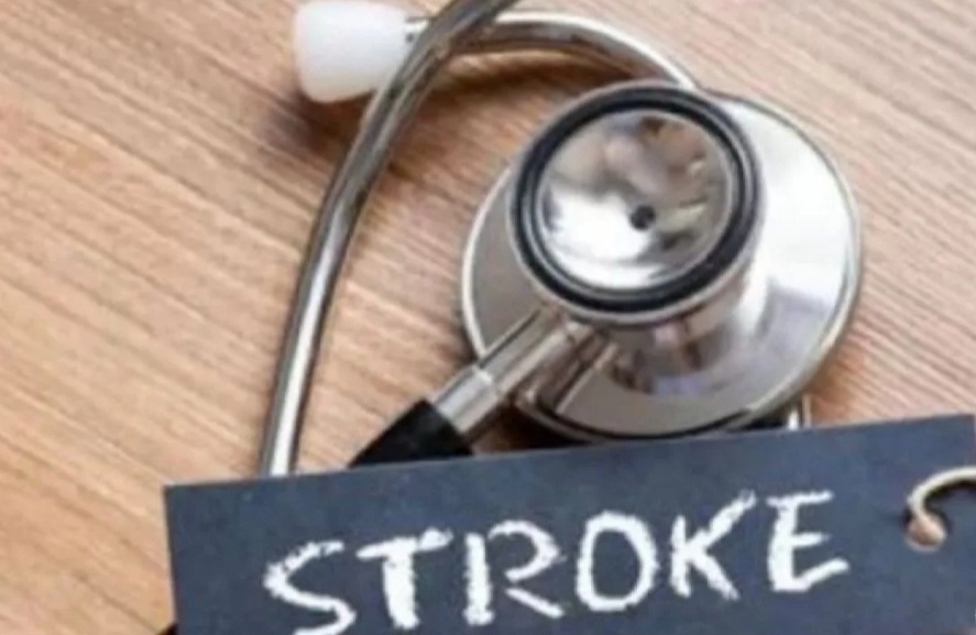 Kenali Gejala Stroke dan Penanganannya