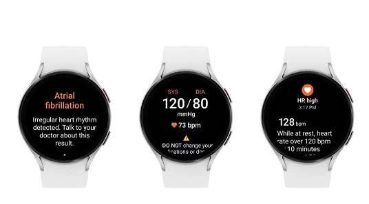 Dengan Fitur di Samsung Watch Ini, Kesehatan Jantung Anda Bisa Dipantau 