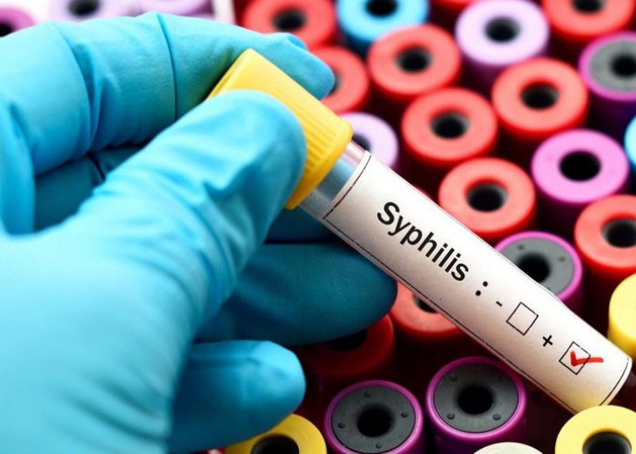 Dinkes Bateng Catat 3 Kasus Sifilis di Tahun 2022, Ingatkan Jangan Gonta Ganti Pasangan