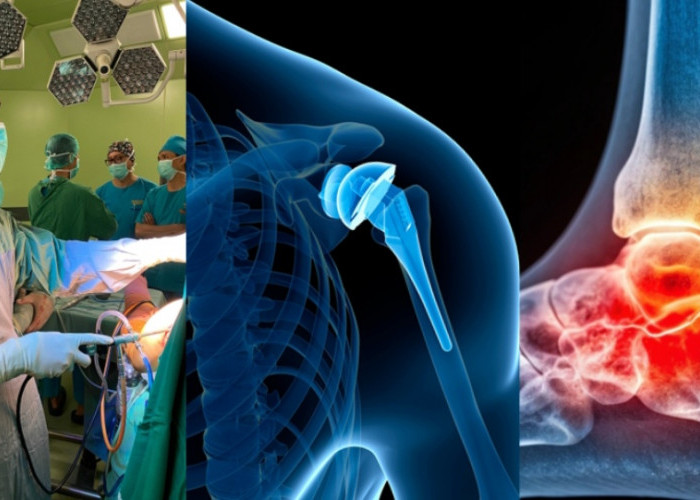 Dokter Spesialis Tulang Garda Terdepan  Penanganan Gangguan Tulang dan Sendi