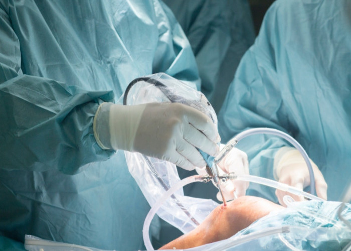 Arthroscopy: Solusi Bedah Minimal Invasif untuk Masalah Sendi