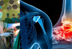 Dokter Spesialis Tulang Garda Terdepan  Penanganan Gangguan Tulang dan Sendi